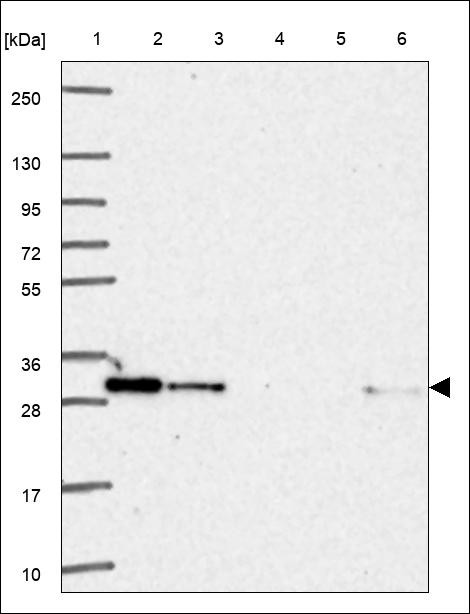 Lane 1: Marker [kDa] 250,130,95,72,55,36,28,17,10 Lane 2: RT4 Lane 3: U-251 MG Lane 4: Human Plasma Lane 5: Liver Lane 6: Tonsil