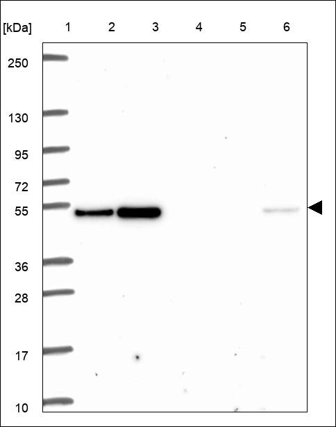 Lane 1: Marker [kDa] 250,130,95,72,55,36,28,17,10 Lane 2: RT4 Lane 3: U-251 MG Lane 4: Human Plasma Lane 5: Liver Lane 6: Tonsil