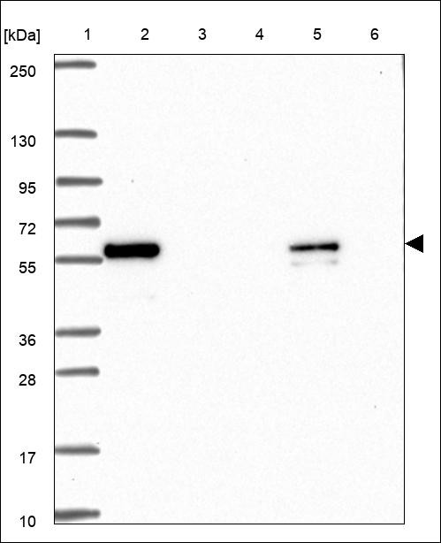 Lane 1: Marker [kDa] 250,130,95,72,55,36,28,17,10 Lane 2: RT4 Lane 3: U-251 MG Lane 4: Human Plasma Lane 5: Liver Lane 6: Tonsil