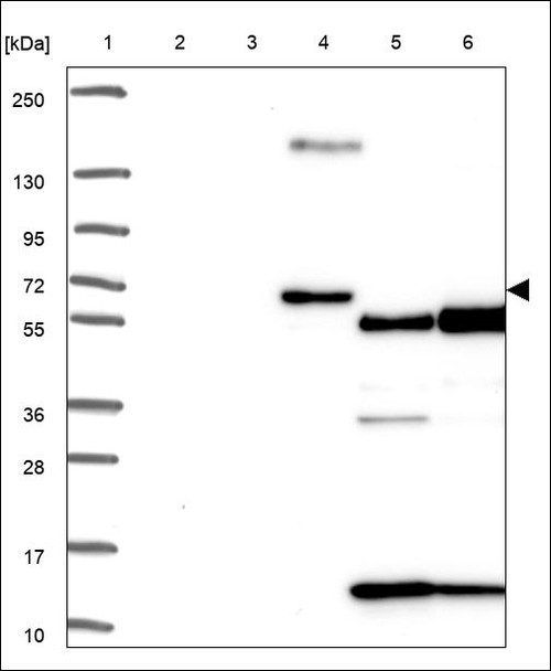 Lane 1: Marker [kDa] 250,130,95,72,55,36,28,17,10 Lane 2: RT4 Lane 3: U-251 MG Lane 4: Human Plasma Lane 5: Liver Lane 6: Tonsil