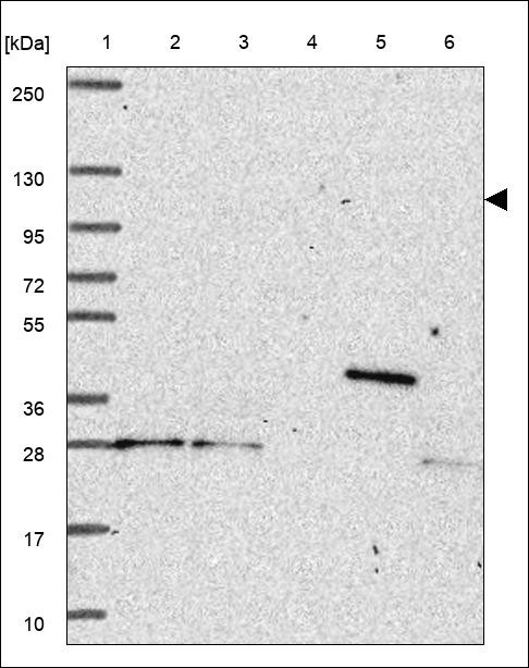 Lane 1: Marker [kDa] 250,130,95,72,55,36,28,17,10 Lane 2: RT4 Lane 3: U-251 MG Lane 4: Human Plasma Lane 5: Liver Lane 6: Tonsil