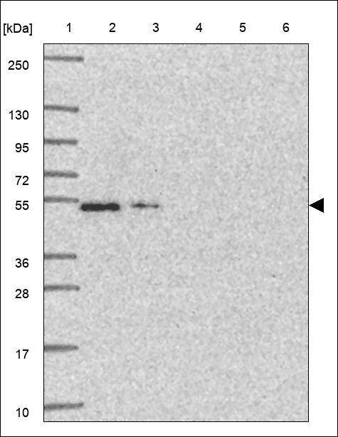 Lane 1: Marker [kDa] 250,130,95,72,55,36,28,17,10 Lane 2: RT4 Lane 3: U-251 MG Lane 4: Human Plasma Lane 5: Liver Lane 6: Tonsil
