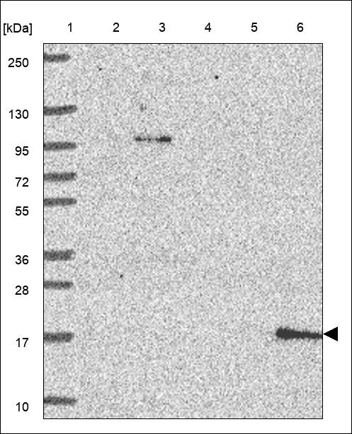 Lane 1: Marker [kDa] 250,130,95,72,55,36,28,17,10 Lane 2: RT4 Lane 3: U-251 MG Lane 4: Human Plasma Lane 5: Liver Lane 6: Tonsil