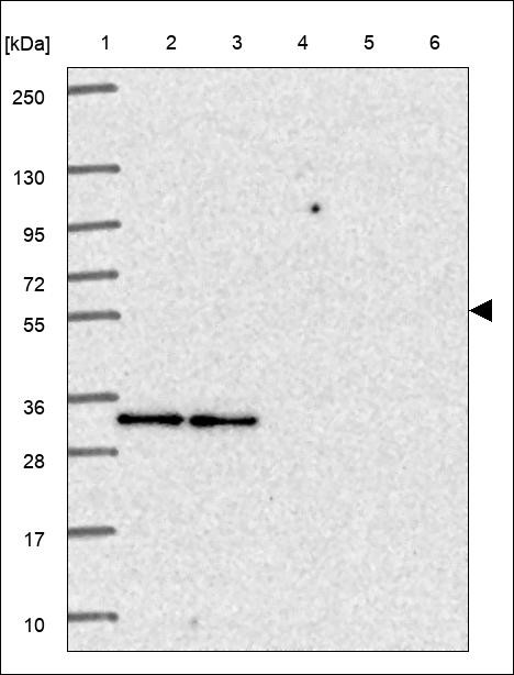 Lane 1: Marker [kDa] 250,130,95,72,55,36,28,17,10 Lane 2: RT4 Lane 3: U-251 MG Lane 4: Human Plasma Lane 5: Liver Lane 6: Tonsil