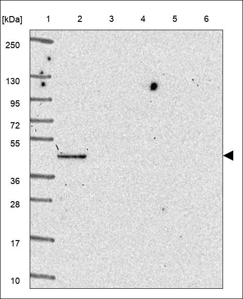 Lane 1: Marker [kDa] 250,130,95,72,55,36,28,17,10 Lane 2: RT4 Lane 3: U-251 MG Lane 4: Human Plasma Lane 5: Liver Lane 6: Tonsil