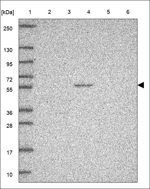 Lane 1: Marker [kDa] 250,130,95,72,55,36,28,17,10 Lane 2: RT4 Lane 3: U-251 MG Lane 4: Human Plasma Lane 5: Liver Lane 6: Tonsil
