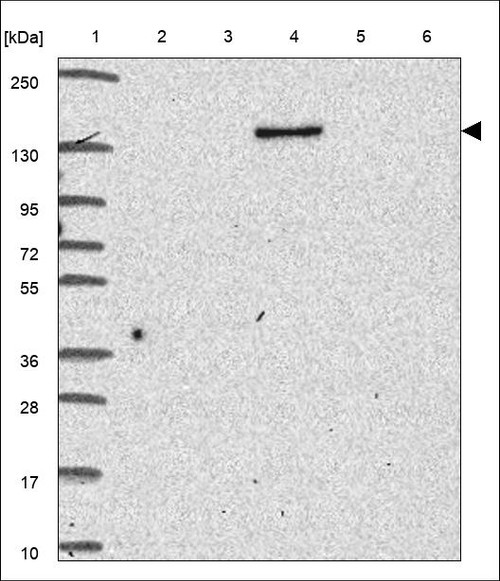 Lane 1: Marker [kDa] 250,130,95,72,55,36,28,17,10 Lane 2: RT4 Lane 3: U-251 MG Lane 4: Human Plasma Lane 5: Liver Lane 6: Tonsil