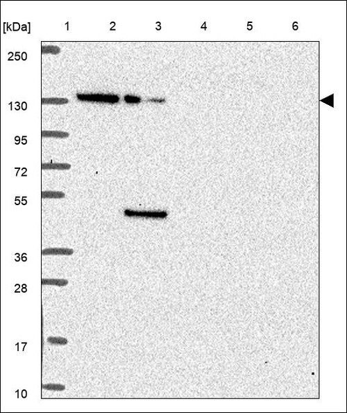 Lane 1: Marker [kDa] 250,130,95,72,55,36,28,17,10 Lane 2: RT4 Lane 3: U-251 MG Lane 4: Human Plasma Lane 5: Liver Lane 6: Tonsil