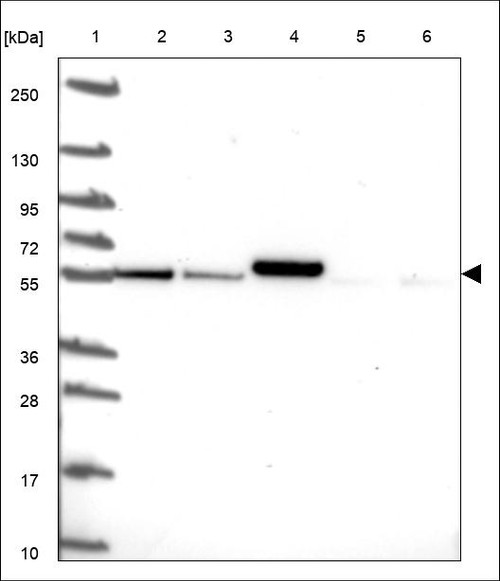 Lane 1: Marker [kDa] 250,130,95,72,55,36,28,17,10 Lane 2: RT4 Lane 3: U-251 MG Lane 4: Human Plasma Lane 5: Liver Lane 6: Tonsil
