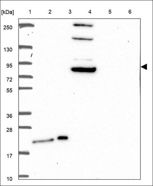 Lane 1: Marker [kDa] 250,130,95,72,55,36,28,17,10 Lane 2: RT4 Lane 3: U-251 MG Lane 4: Human Plasma Lane 5: Liver Lane 6: Tonsil