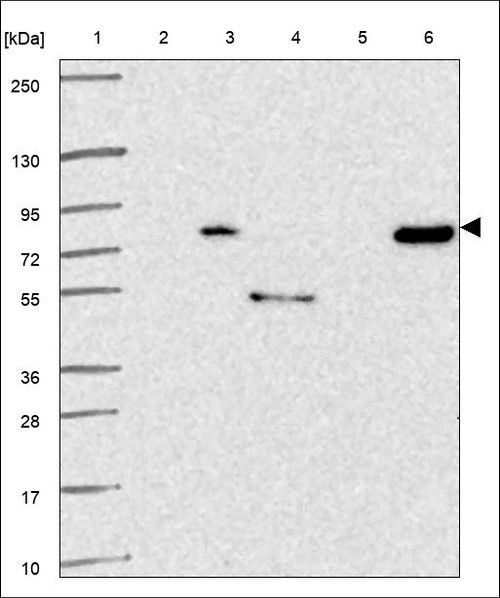 Lane 1: Marker [kDa] 250,130,95,72,55,36,28,17,10 Lane 2: RT4 Lane 3: U-251 MG Lane 4: Human Plasma Lane 5: Liver Lane 6: Tonsil