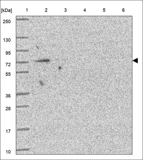 Lane 1: Marker [kDa] 250,130,95,72,55,36,28,17,10 Lane 2: RT4 Lane 3: U-251 MG Lane 4: Human Plasma Lane 5: Liver Lane 6: Tonsil