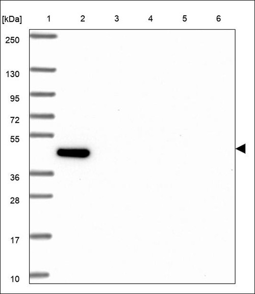 Lane 1: Marker [kDa] 250,130,95,72,55,36,28,17,10 Lane 2: RT4 Lane 3: U-251 MG Lane 4: Human Plasma Lane 5: Liver Lane 6: Tonsil