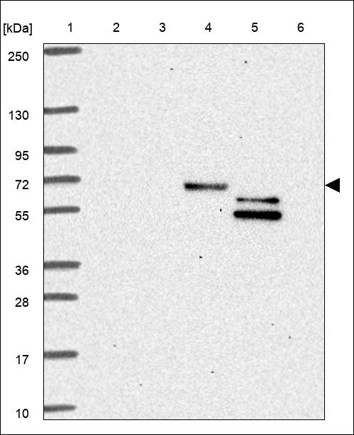 Lane 1: Marker [kDa] 250,130,95,72,55,36,28,17,10 Lane 2: RT4 Lane 3: U-251 MG Lane 4: Human Plasma Lane 5: Liver Lane 6: Tonsil