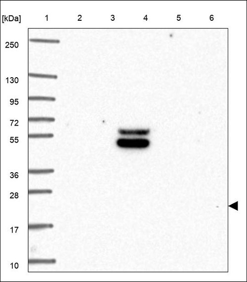 Lane 1: Marker [kDa] 250,130,95,72,55,36,28,17,10 Lane 2: RT4 Lane 3: U-251 MG Lane 4: Human Plasma Lane 5: Liver Lane 6: Tonsil
