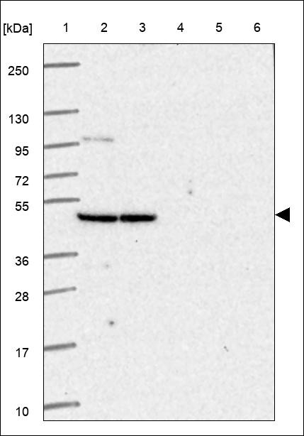 Lane 1: Marker [kDa] 250,130,95,72,55,36,28,17,10 Lane 2: RT4 Lane 3: U-251 MG Lane 4: Human Plasma Lane 5: Liver Lane 6: Tonsil