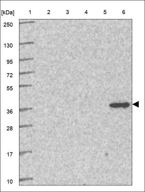 Lane 1: Marker [kDa] 250,130,95,72,55,36,28,17,10 Lane 2: RT4 Lane 3: U-251 MG Lane 4: Human Plasma Lane 5: Liver Lane 6: Tonsil