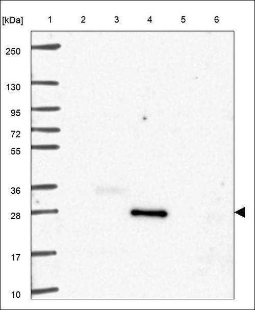 Lane 1: Marker [kDa] 250,130,95,72,55,36,28,17,10 Lane 2: RT4 Lane 3: U-251 MG Lane 4: Human Plasma Lane 5: Liver Lane 6: Tonsil