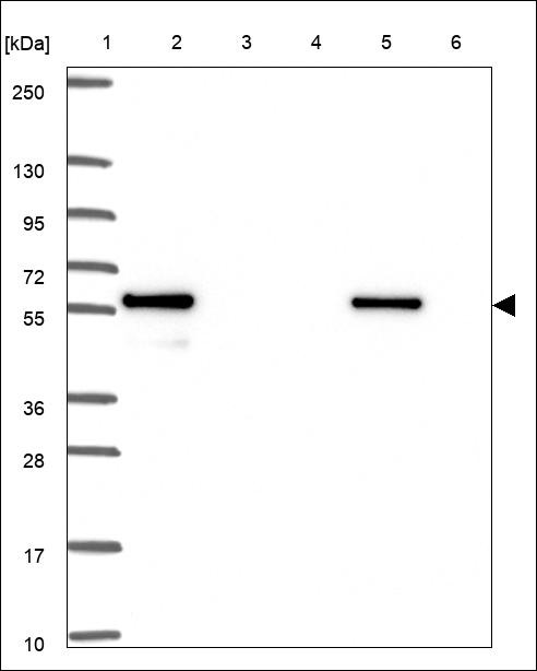Lane 1: Marker [kDa] 250,130,95,72,55,36,28,17,10 Lane 2: RT4 Lane 3: U-251 MG Lane 4: Human Plasma Lane 5: Liver Lane 6: Tonsil