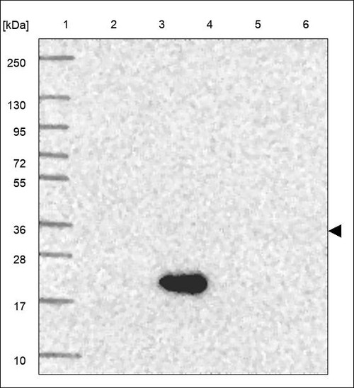 Lane 1: Marker [kDa] 250,130,95,72,55,36,28,17,10 Lane 2: RT4 Lane 3: U-251 MG Lane 4: Human Plasma Lane 5: Liver Lane 6: Tonsil