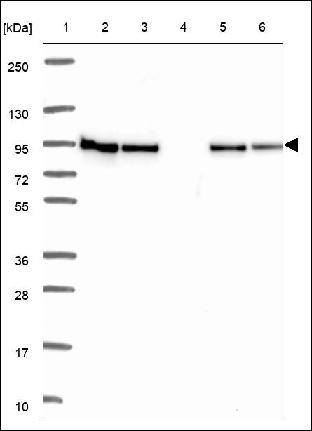 Lane 1: Marker [kDa] 250,130,95,72,55,36,28,17,10 Lane 2: RT4 Lane 3: U-251 MG Lane 4: Human Plasma Lane 5: Liver Lane 6: Tonsil