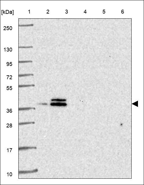 Lane 1: Marker [kDa] 250,130,95,72,55,36,28,17,10 Lane 2: RT4 Lane 3: U-251 MG Lane 4: Human Plasma Lane 5: Liver Lane 6: Tonsil