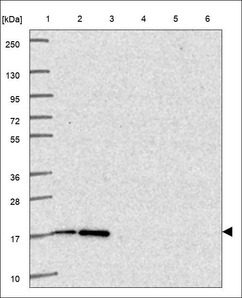 Lane 1: Marker [kDa] 250,130,95,72,55,36,28,17,10 Lane 2: RT4 Lane 3: U-251 MG Lane 4: Human Plasma Lane 5: Liver Lane 6: Tonsil
