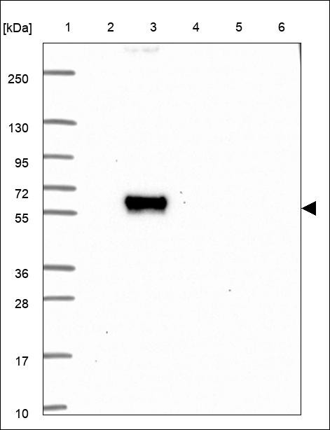 Lane 1: Marker [kDa] 250,130,95,72,55,36,28,17,10 Lane 2: RT4 Lane 3: U-251 MG Lane 4: Human Plasma Lane 5: Liver Lane 6: Tonsil