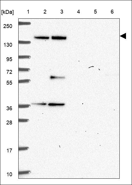 Lane 1: Marker [kDa] 250,130,95,72,55,36,28,17,10 Lane 2: RT4 Lane 3: U-251 MG Lane 4: Human Plasma Lane 5: Liver Lane 6: Tonsil
