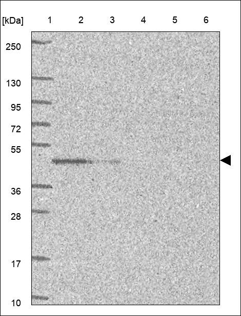 Lane 1: Marker [kDa] 250,130,95,72,55,36,28,17,10 Lane 2: RT4 Lane 3: U-251 MG Lane 4: Human Plasma Lane 5: Liver Lane 6: Tonsil