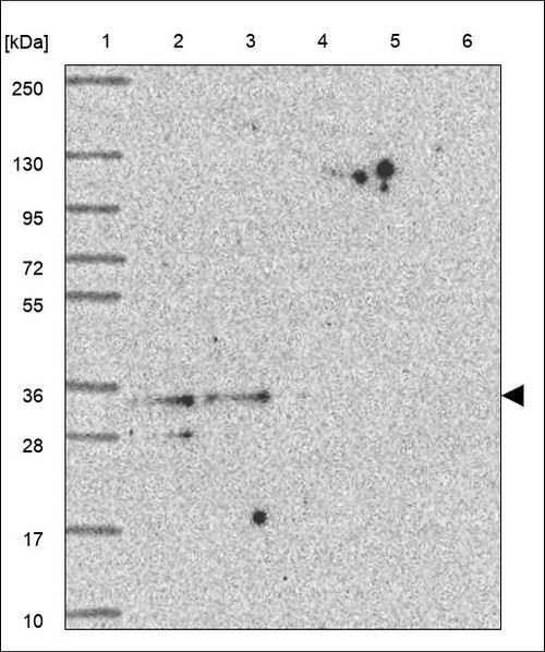 Lane 1: Marker [kDa] 250,130,95,72,55,36,28,17,10 Lane 2: RT4 Lane 3: U-251 MG Lane 4: Human Plasma Lane 5: Liver Lane 6: Tonsil