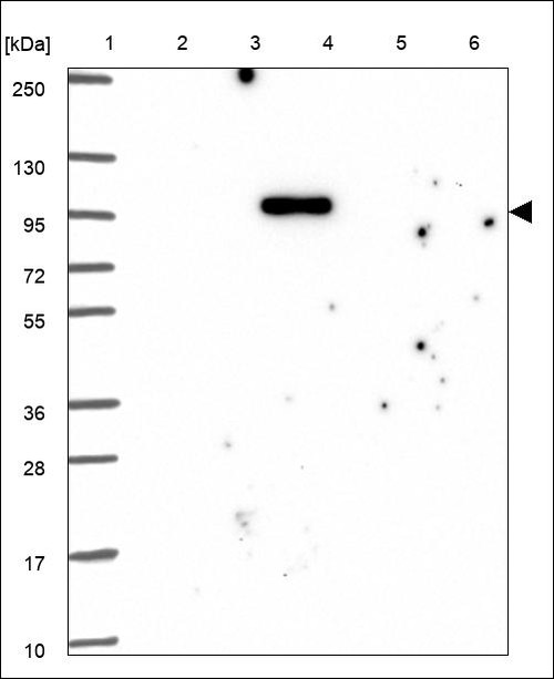 Lane 1: Marker [kDa] 250,130,95,72,55,36,28,17,10 Lane 2: RT4 Lane 3: U-251 MG Lane 4: Human Plasma Lane 5: Liver Lane 6: Tonsil
