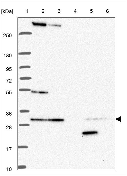 Lane 1: Marker [kDa] 250,130,95,72,55,36,28,17,10 Lane 2: RT4 Lane 3: U-251 MG Lane 4: Human Plasma Lane 5: Liver Lane 6: Tonsil
