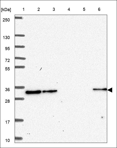 Lane 1: Marker [kDa] 250,130,95,72,55,36,28,17,10 Lane 2: RT4 Lane 3: U-251 MG Lane 4: Human Plasma Lane 5: Liver Lane 6: Tonsil