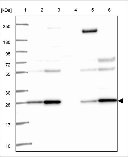 Lane 1: Marker [kDa] 250,130,95,72,55,36,28,17,10 Lane 2: RT4 Lane 3: U-251 MG Lane 4: Human Plasma Lane 5: Liver Lane 6: Tonsil