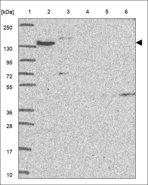 Lane 1: Marker [kDa] 250,130,95,72,55,36,28,17,10 Lane 2: RT4 Lane 3: U-251 MG Lane 4: Human Plasma Lane 5: Liver Lane 6: Tonsil