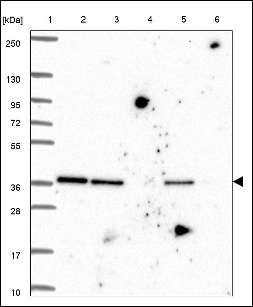 Lane 1: Marker [kDa] 250,130,95,72,55,36,28,17,10 Lane 2: RT4 Lane 3: U-251 MG Lane 4: Human Plasma Lane 5: Liver Lane 6: Tonsil
