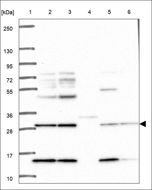 Lane 1: Marker [kDa] 250,130,95,72,55,36,28,17,10 Lane 2: RT4 Lane 3: U-251 MG Lane 4: Human Plasma Lane 5: Liver Lane 6: Tonsil