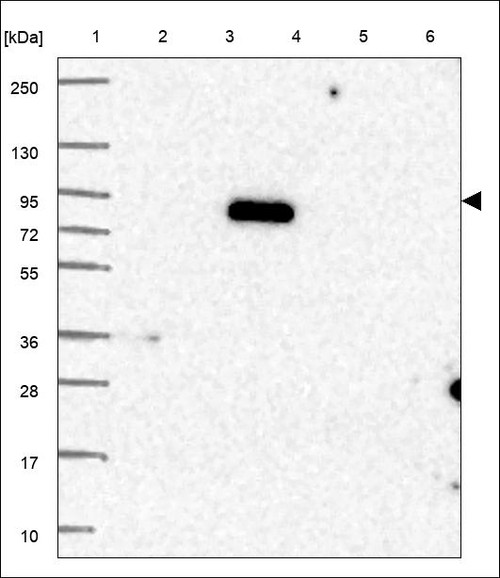 Lane 1: Marker [kDa] 250,130,95,72,55,36,28,17,10 Lane 2: RT4 Lane 3: U-251 MG Lane 4: Human Plasma Lane 5: Liver Lane 6: Tonsil