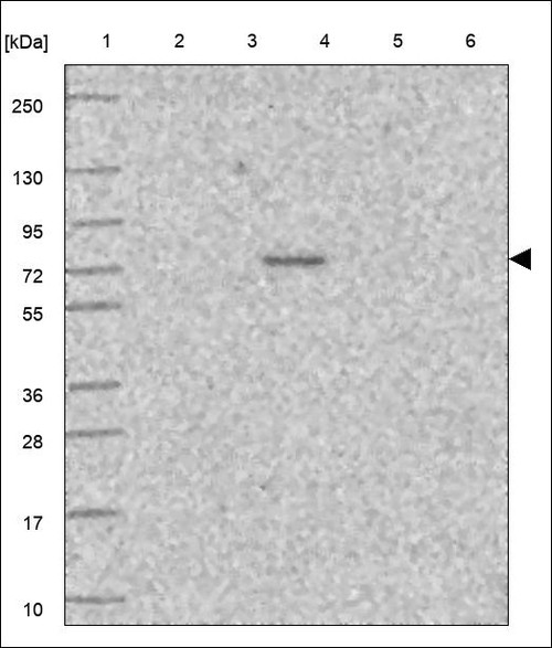 Lane 1: Marker [kDa] 250,130,95,72,55,36,28,17,10 Lane 2: RT4 Lane 3: U-251 MG Lane 4: Human Plasma Lane 5: Liver Lane 6: Tonsil
