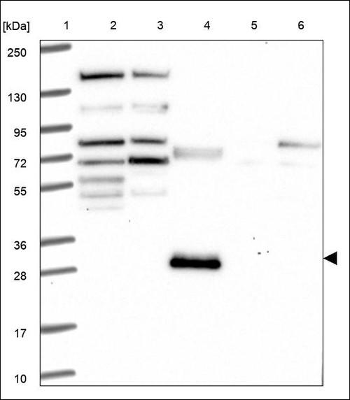 Lane 1: Marker [kDa] 250,130,95,72,55,36,28,17,10 Lane 2: RT4 Lane 3: U-251 MG Lane 4: Human Plasma Lane 5: Liver Lane 6: Tonsil