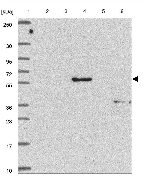 Lane 1: Marker [kDa] 250,130,95,72,55,36,28,17,10 Lane 2: RT4 Lane 3: U-251 MG Lane 4: Human Plasma Lane 5: Liver Lane 6: Tonsil