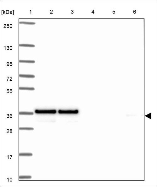 Lane 1: Marker [kDa] 250,130,95,72,55,36,28,17,10 Lane 2: RT4 Lane 3: U-251 MG Lane 4: Human Plasma Lane 5: Liver Lane 6: Tonsil