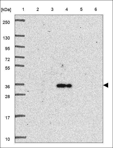 Lane 1: Marker [kDa] 250,130,95,72,55,36,28,17,10 Lane 2: RT4 Lane 3: U-251 MG Lane 4: Human Plasma Lane 5: Liver Lane 6: Tonsil