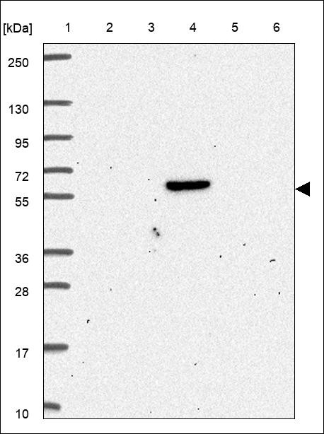 Lane 1: Marker [kDa] 250,130,95,72,55,36,28,17,10 Lane 2: RT4 Lane 3: U-251 MG Lane 4: Human Plasma Lane 5: Liver Lane 6: Tonsil