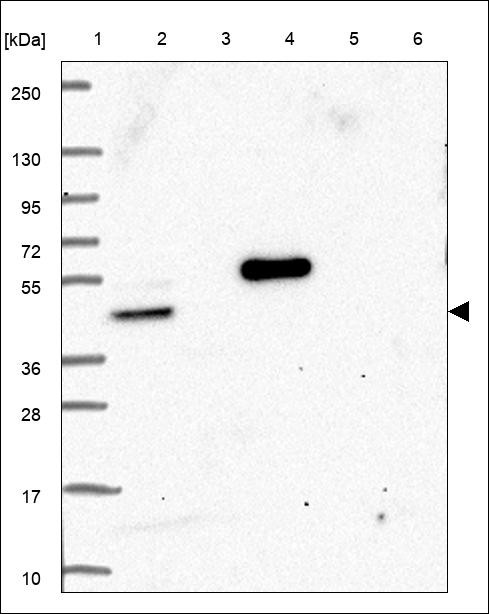 Lane 1: Marker [kDa] 250,130,95,72,55,36,28,17,10 Lane 2: RT4 Lane 3: U-251 MG Lane 4: Human Plasma Lane 5: Liver Lane 6: Tonsil