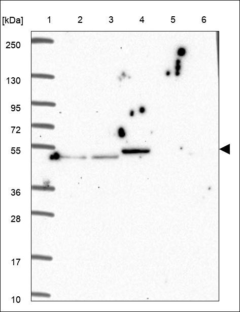 Lane 1: Marker [kDa] 250,130,95,72,55,36,28,17,10 Lane 2: RT4 Lane 3: U-251 MG Lane 4: Human Plasma Lane 5: Liver Lane 6: Tonsil
