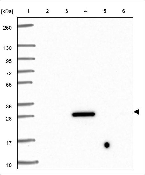 Lane 1: Marker [kDa] 250,130,95,72,55,36,28,17,10 Lane 2: RT4 Lane 3: U-251 MG Lane 4: Human Plasma Lane 5: Liver Lane 6: Tonsil
