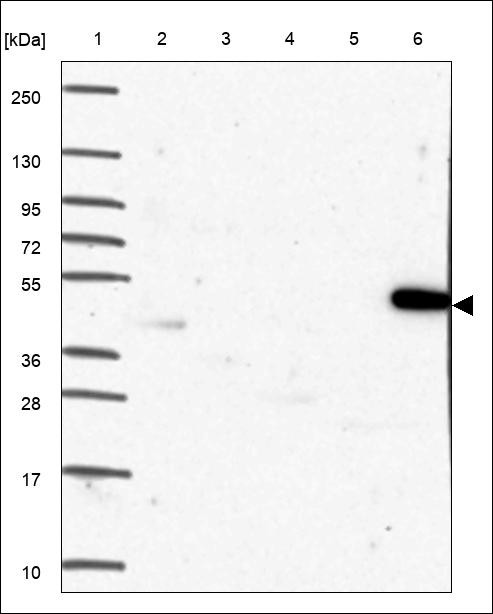 Lane 1: Marker [kDa] 250,130,95,72,55,36,28,17,10 Lane 2: RT4 Lane 3: U-251 MG Lane 4: Human Plasma Lane 5: Liver Lane 6: Tonsil