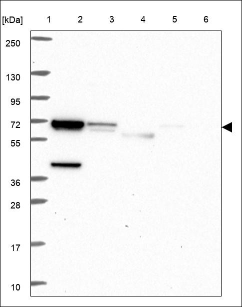 Lane 1: Marker [kDa] 250,130,95,72,55,36,28,17,10 Lane 2: RT4 Lane 3: U-251 MG Lane 4: Human Plasma Lane 5: Liver Lane 6: Tonsil